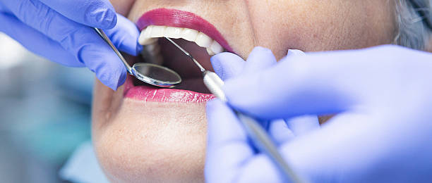 Best Emergency Tooth Extraction in Ten Mile Creek, MD